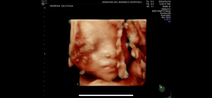 Birth album, June 2024
