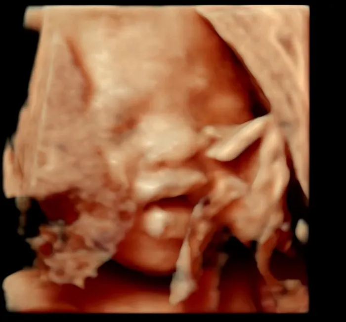 Ultrasound Imaging My Lip