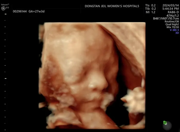 Ultrasound Imaging when i did not recognize